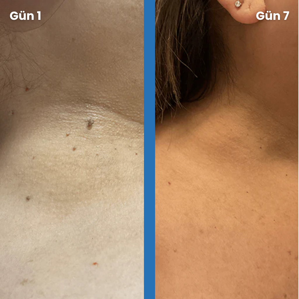 Dermaris® Pürüzsüz Cilt Kiti