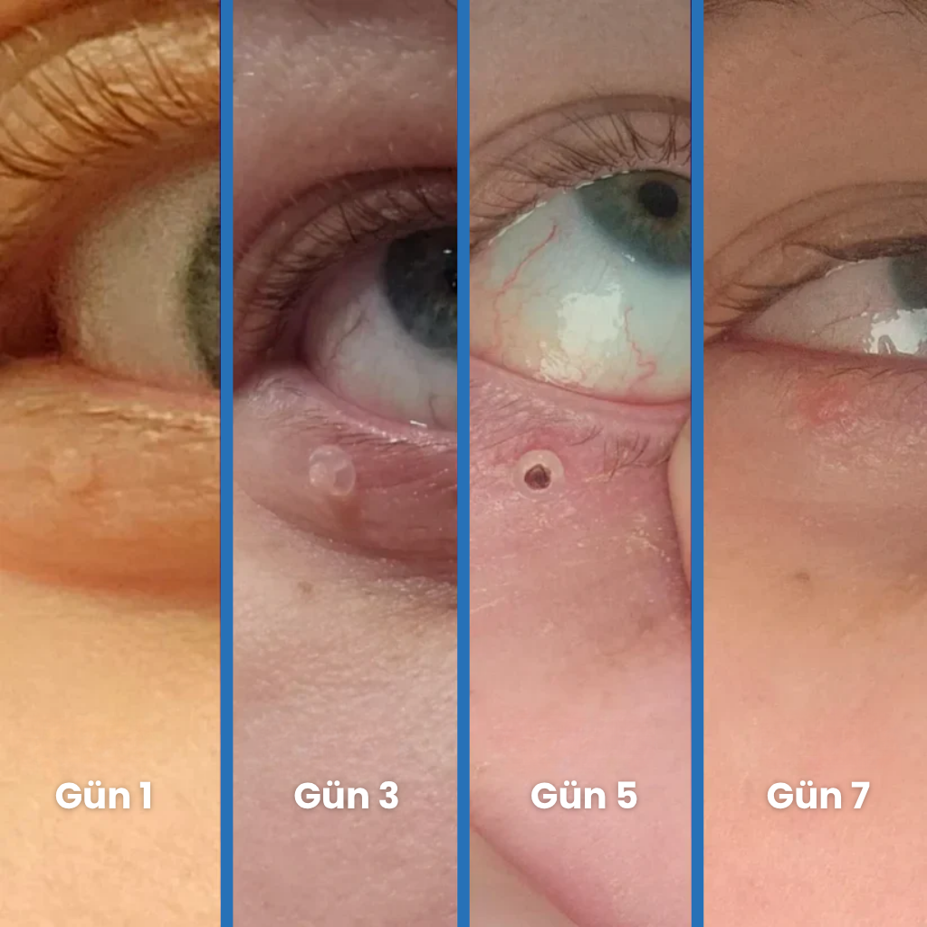 Dermaris® Pürüzsüz Cilt Kiti