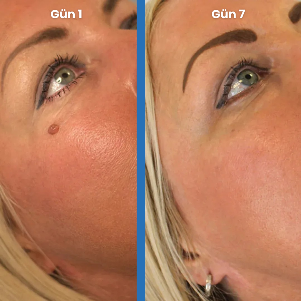 Dermaris® Pürüzsüz Cilt Kiti